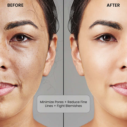 Vince Niacinamide + Zinc Serum